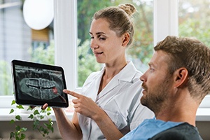 Dentist showing patient an X-ray of his wisdom tooth